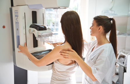 A screening mammogram